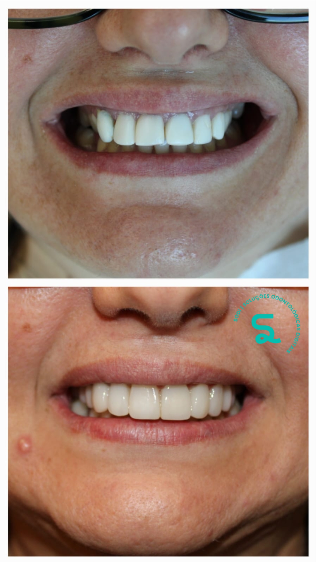 PACIENTE NIEDJA - FACETA